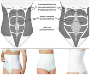 postpartum girdle