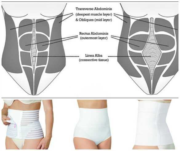 Should I wear a belly band or abdominal support after giving birth?