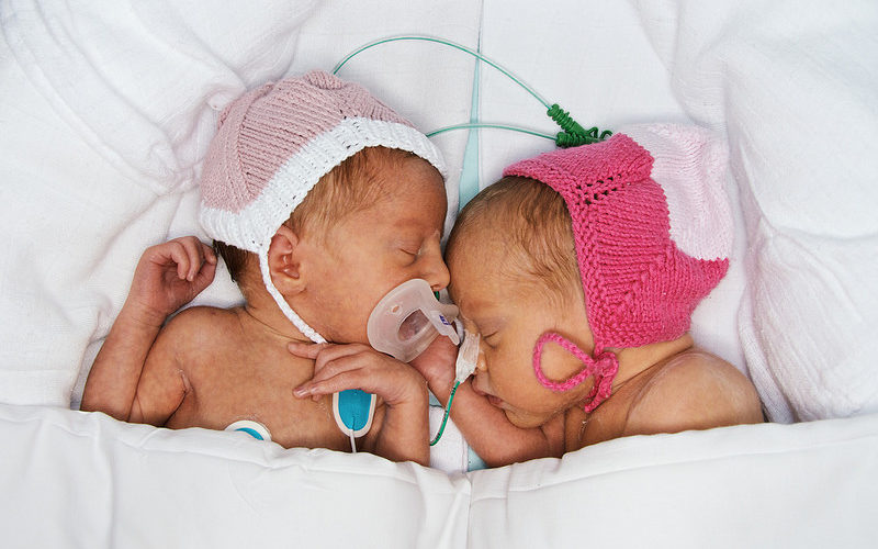 Micro Preemie Survival Rates and Health Concerns