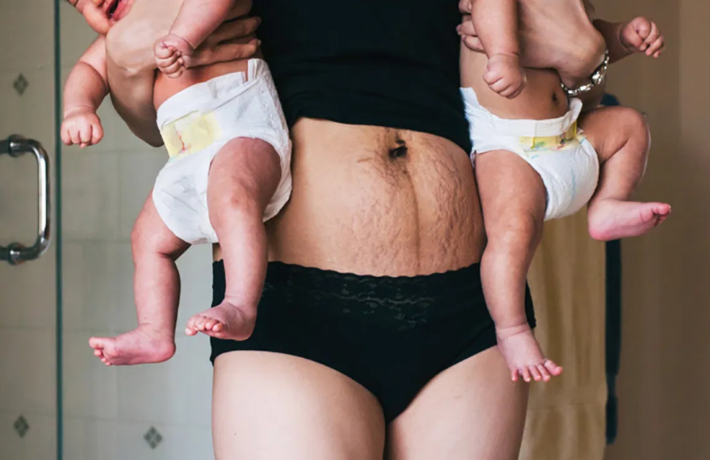 Powerful photos show women's bodies after giving birth - Los